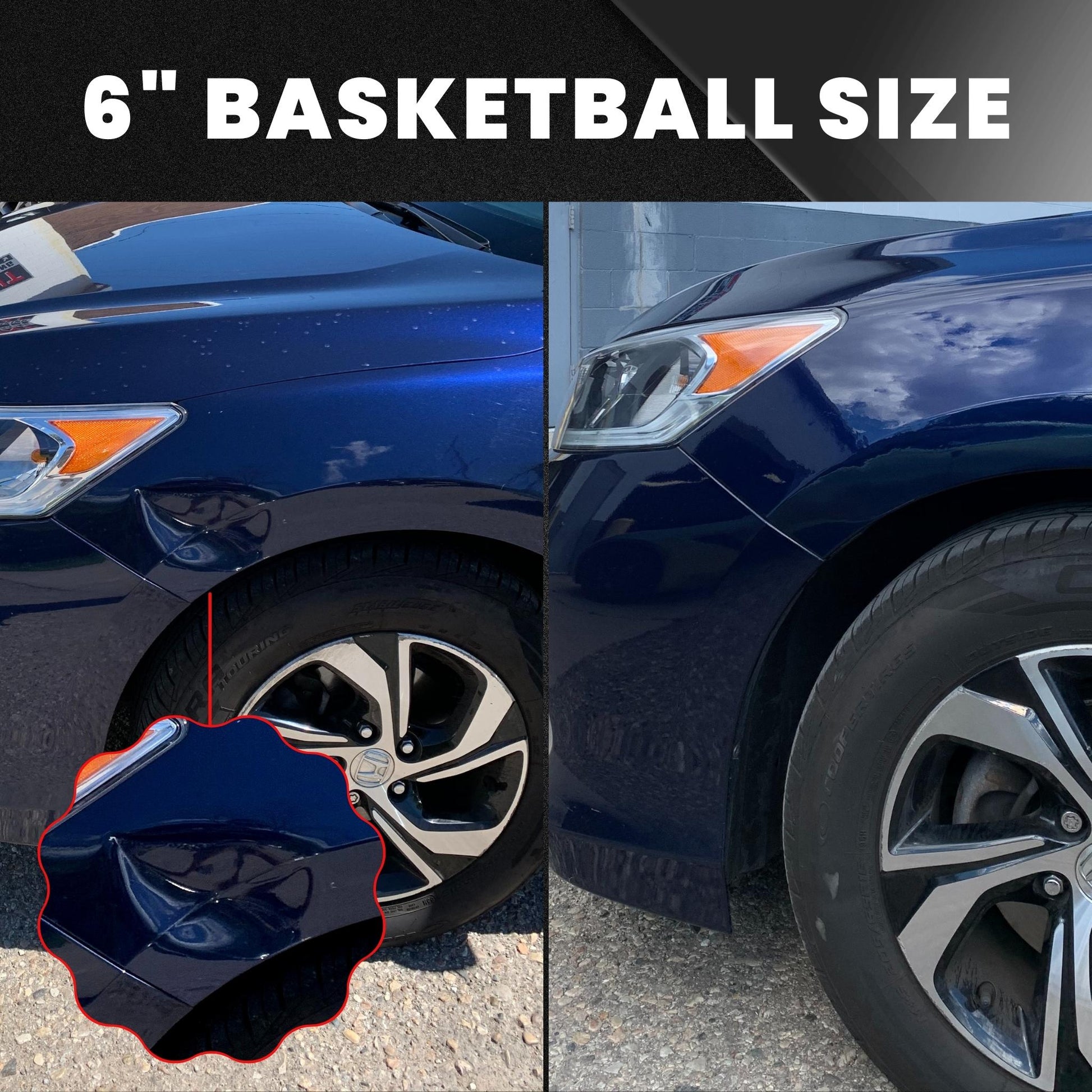 Dent Erasers Authority Build